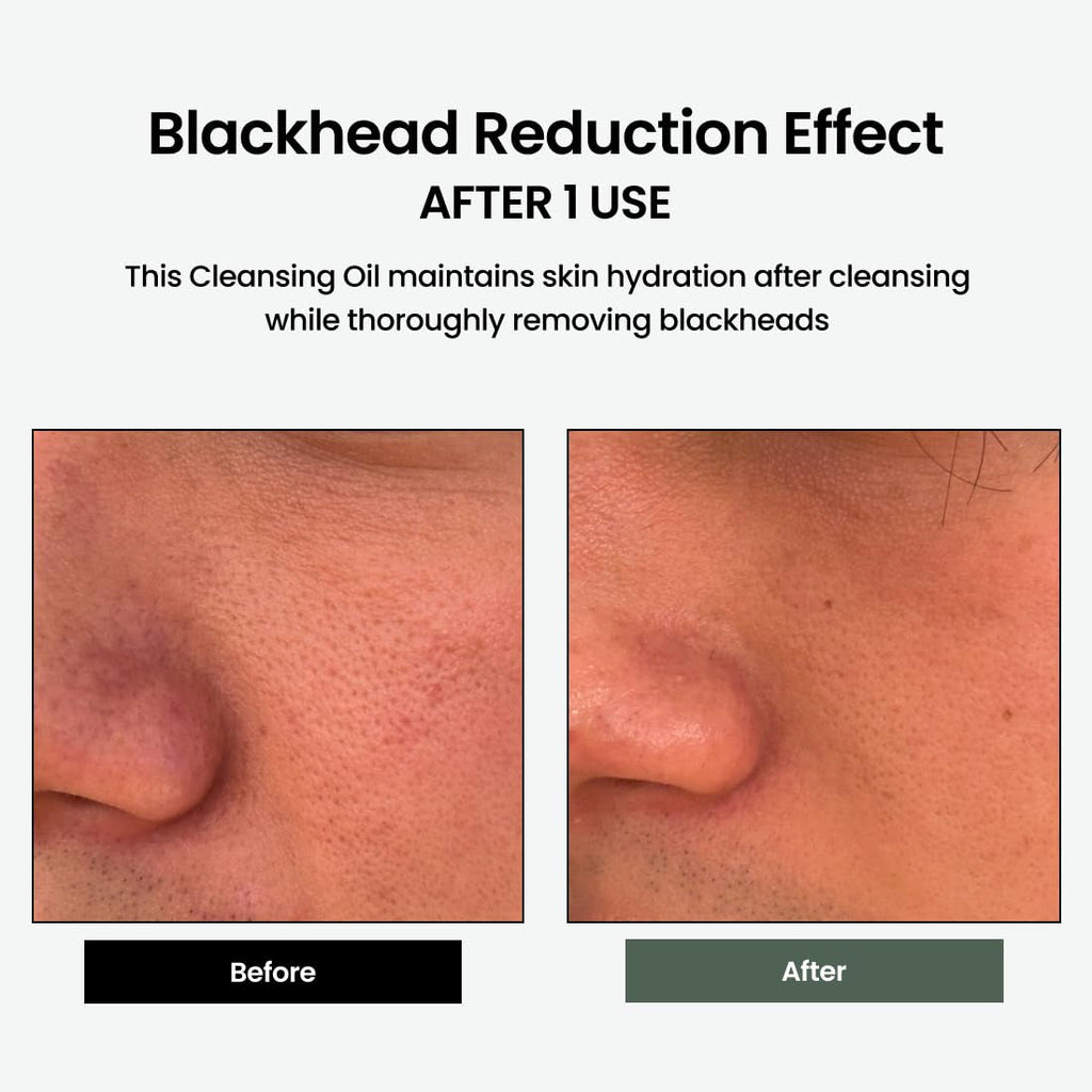 Korean Skincare Liposome Daily Cleansing Oil - Gentle Makeup & Blackhead Remover for Sensitive Skin