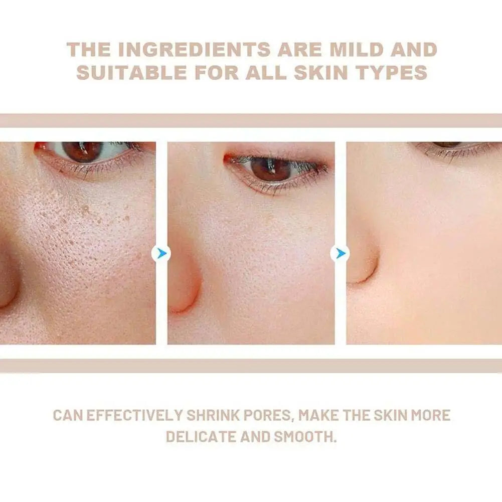 Dr. Melaxin Rice Exfoliating Essence White or Black Rice Peeling Ampoule Exfoliating  Serum Korean Skin Care